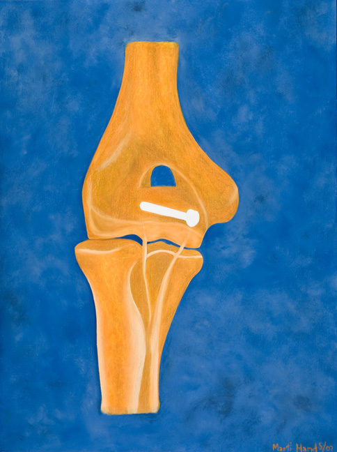 medical-paintings-bone-screw